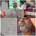 Medical Negligence Alleged at GMC Baramulla: Foreign Body Missed for Months, Patient Suffers Weeks of Pain and Financial loss