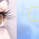 World Sight Day: Don’t ignore blurred vision, floaters, flashes, ophthalmologists warn